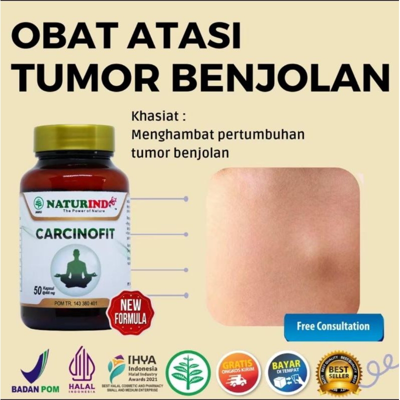 

CARCINOFIT Manfaat Dan Khasiat : Mengatasi tumor benjolan, Menghambat pertumbuhan sel kanker, Mengurangi nyeri & bengkak, Meredakan tumor secara alami, Meningkatkan daya tahan tubuh.