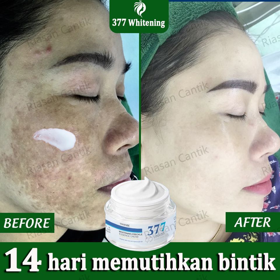 Krim Pemutih Wajah Bpom Mencerahkan Kulit Wajah 50g Cream Flek Hitam Membandel Penghilang Flek Hitam