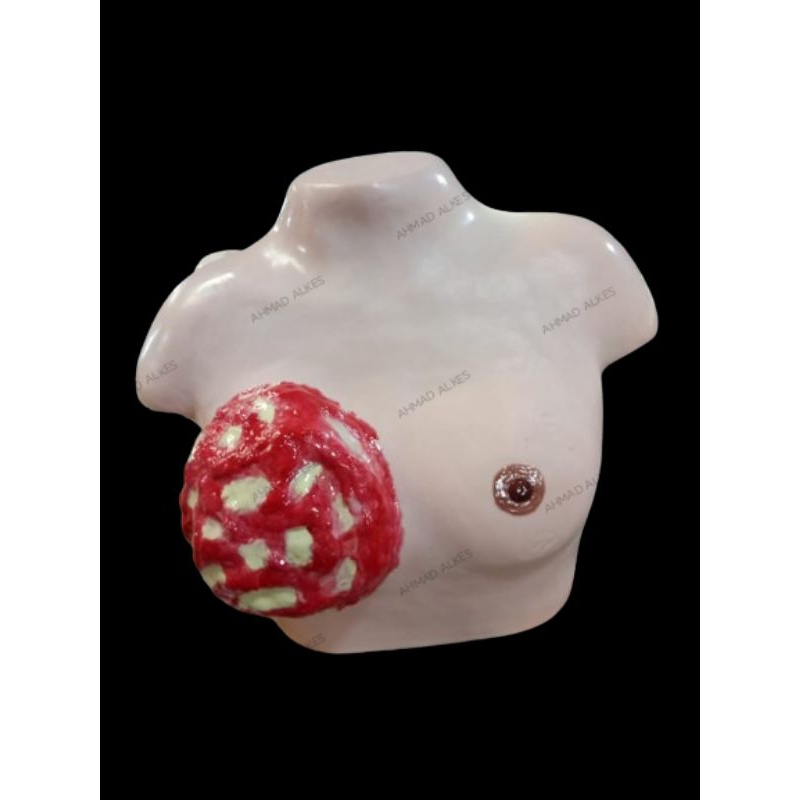 PAYUDARA TUMOR/PAYUDARA KANGKER/PHANTON PAYUDARA/ALAT PERAGA PAYUDARA TUMOR/KANKER/MANEKIN/MANIKIN/P