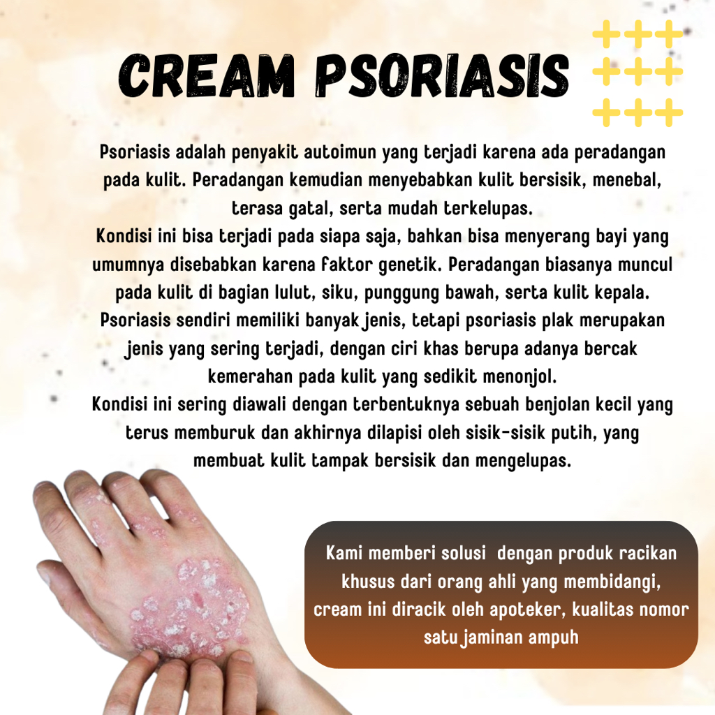 PSORIASIS Cream Medikafhrma Obat Prosiasis Eksim Siku Kepala Gatal Ampuh