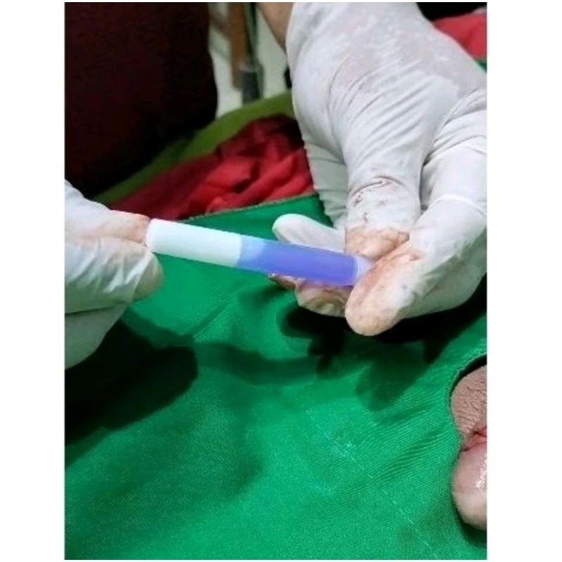 Lem sunat 1ml / lem khitan / lem sunat