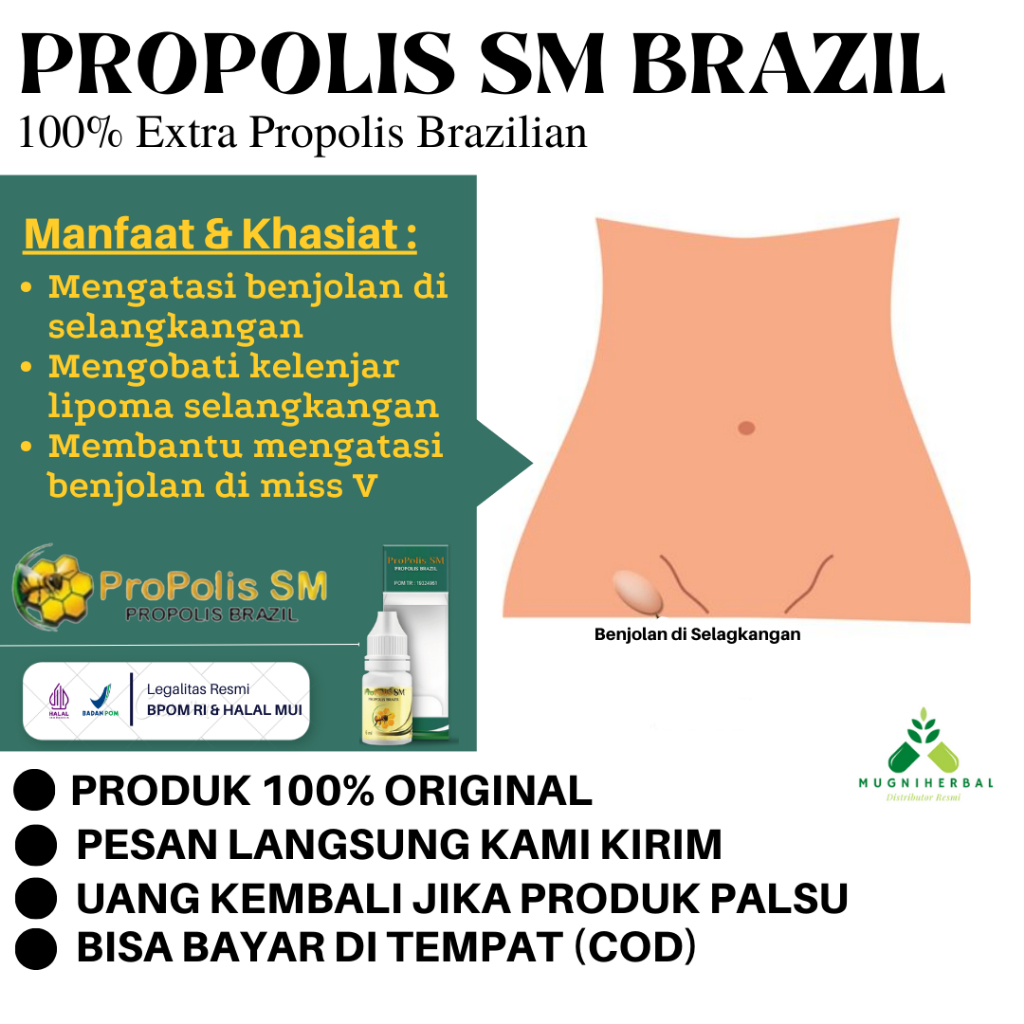 Obat Benjolan di Selangkangan, Kelenjar Lipoma Selangkangan, Benjolan Pada Selangkangan Wanita / Pri