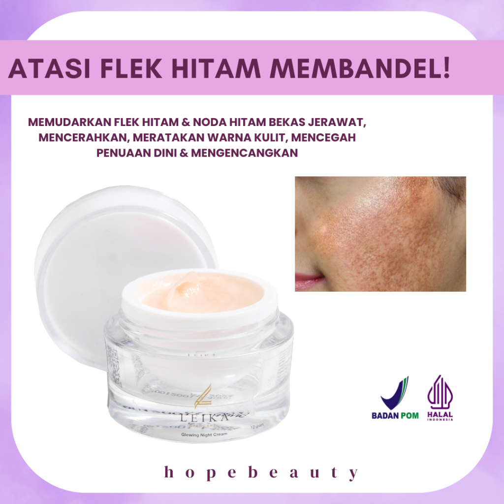 KRIM MALAM Penghilang Flek Hitam Di Wajah Cream Flek Hitam Membandel Cream Flek Hitam Bpom Cream Fle