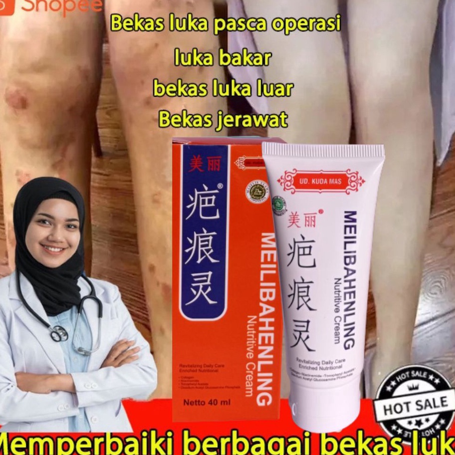 MEGA SALE Penghilang Bekas Luka Meilibahenling BPOM Cream Penghilang Bekas Cacar Koreng Penghilang B