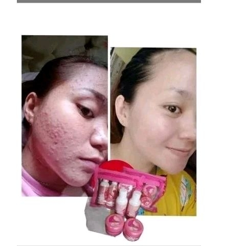Skincare WSP