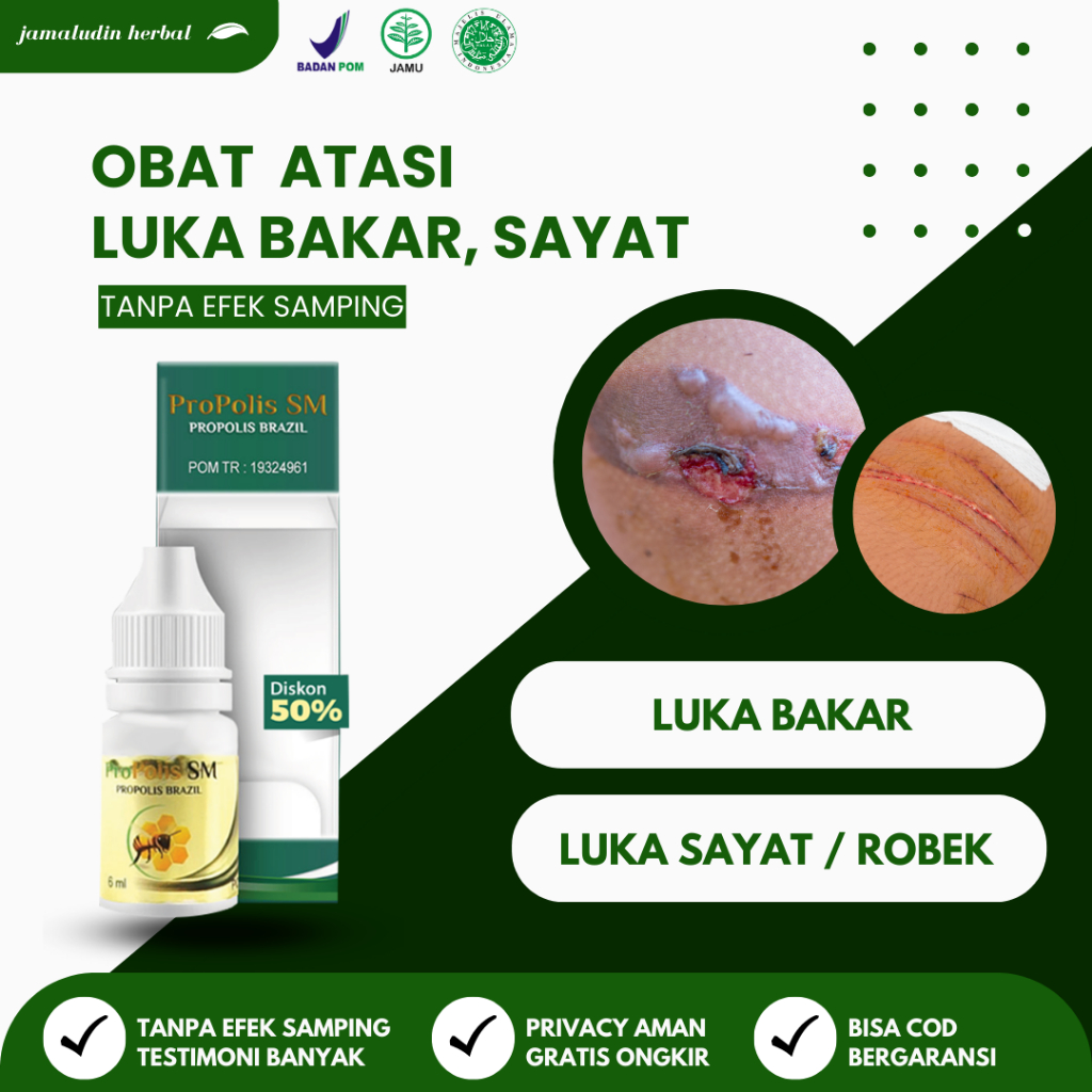 Obat Luka Jatuh Dari Motor, Luka Bakar, Luka Bernanah, Luka Jatuh, Luka Agar Kering, Luka Lecet