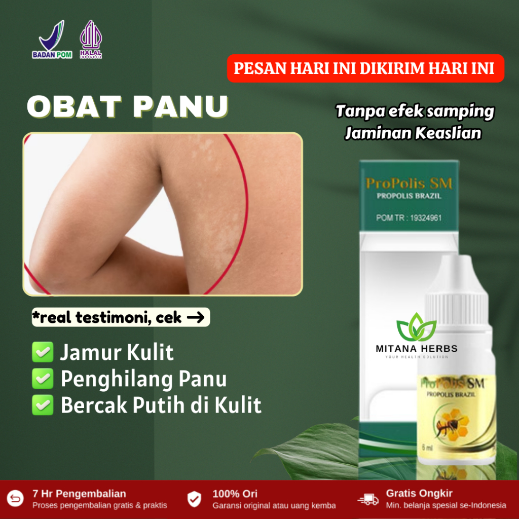 Obat Jamur Kulit, Obat Panu, Salep Jamur Kulit, Penghilang Panu di Wajah, Panu Anak, Obat Hapur