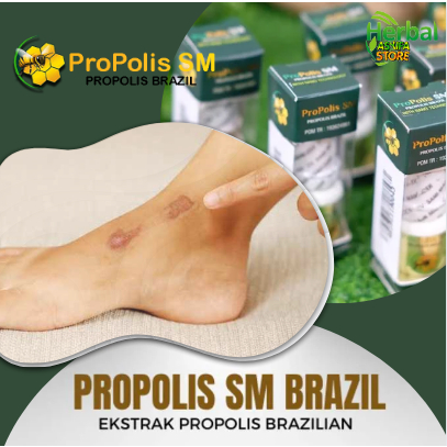 Obat Penghilang Bekas Luka Di Kaki - Salep Cair Penghilang Bekas Luka Hitam Di Kaki, Herbal Penghila