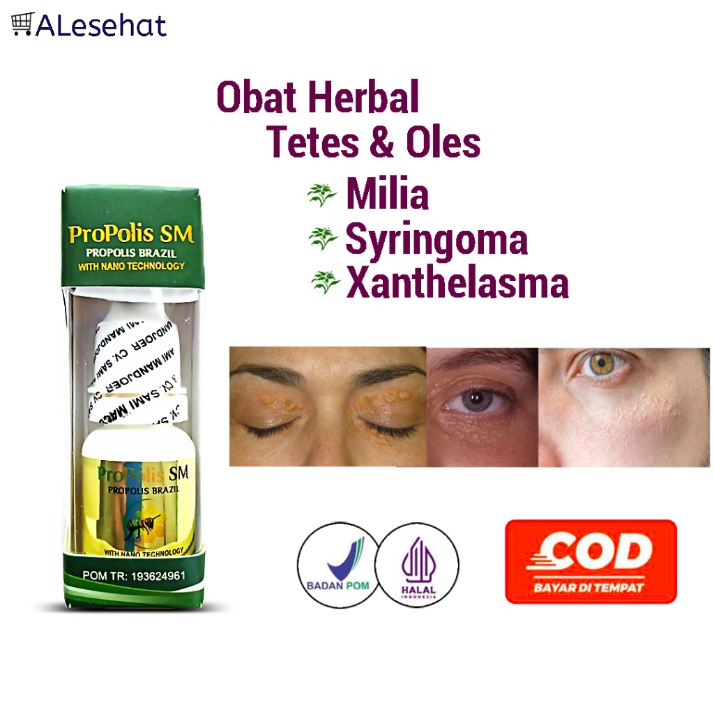 Obat Milia, Syringoma & Xanthelasma Propolis SM
