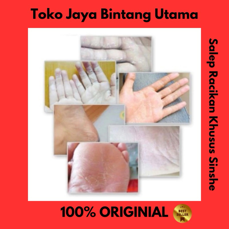 Salep Herbal untuk kulit tangan & kaki pecah, mengelupas, hingga kering