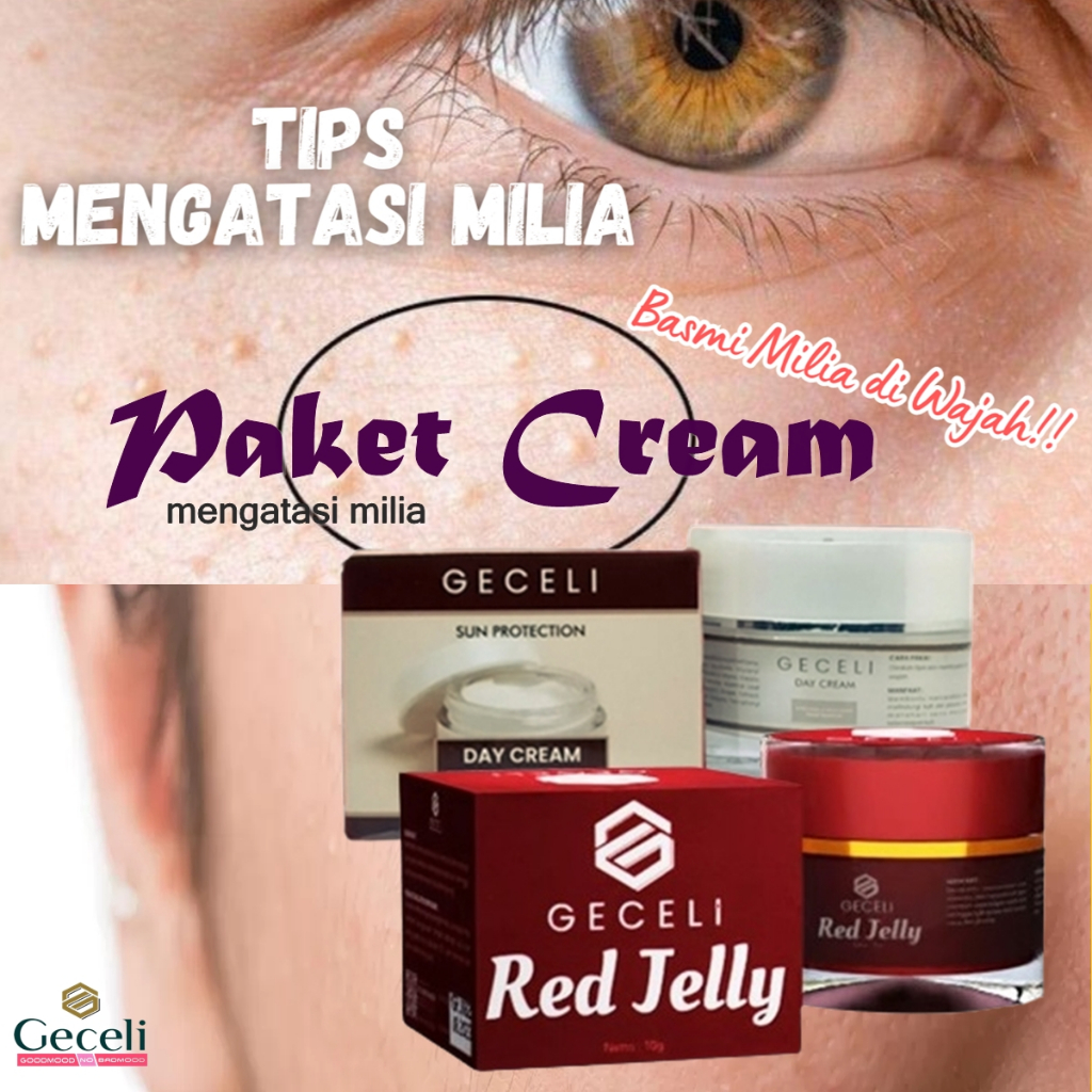 Paket 2 in 1 Original Cream Milia Penghilang Milia Paling Ampuh Cream Milia Ampuh Bpom Penghilang Mi