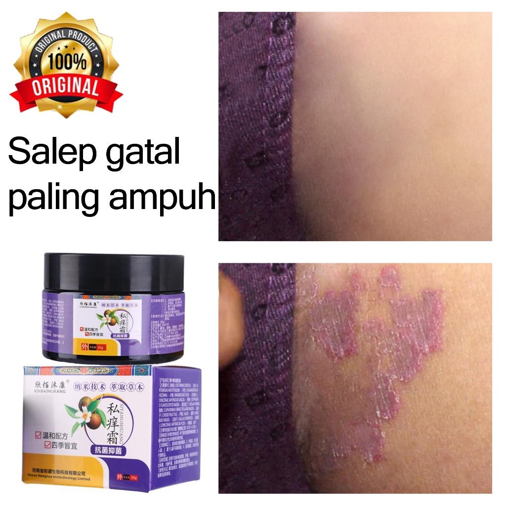 obat kurap paling ampuh salap gatal kulit yang ampuh Salep gatal selangkangan salep selangkangan gat