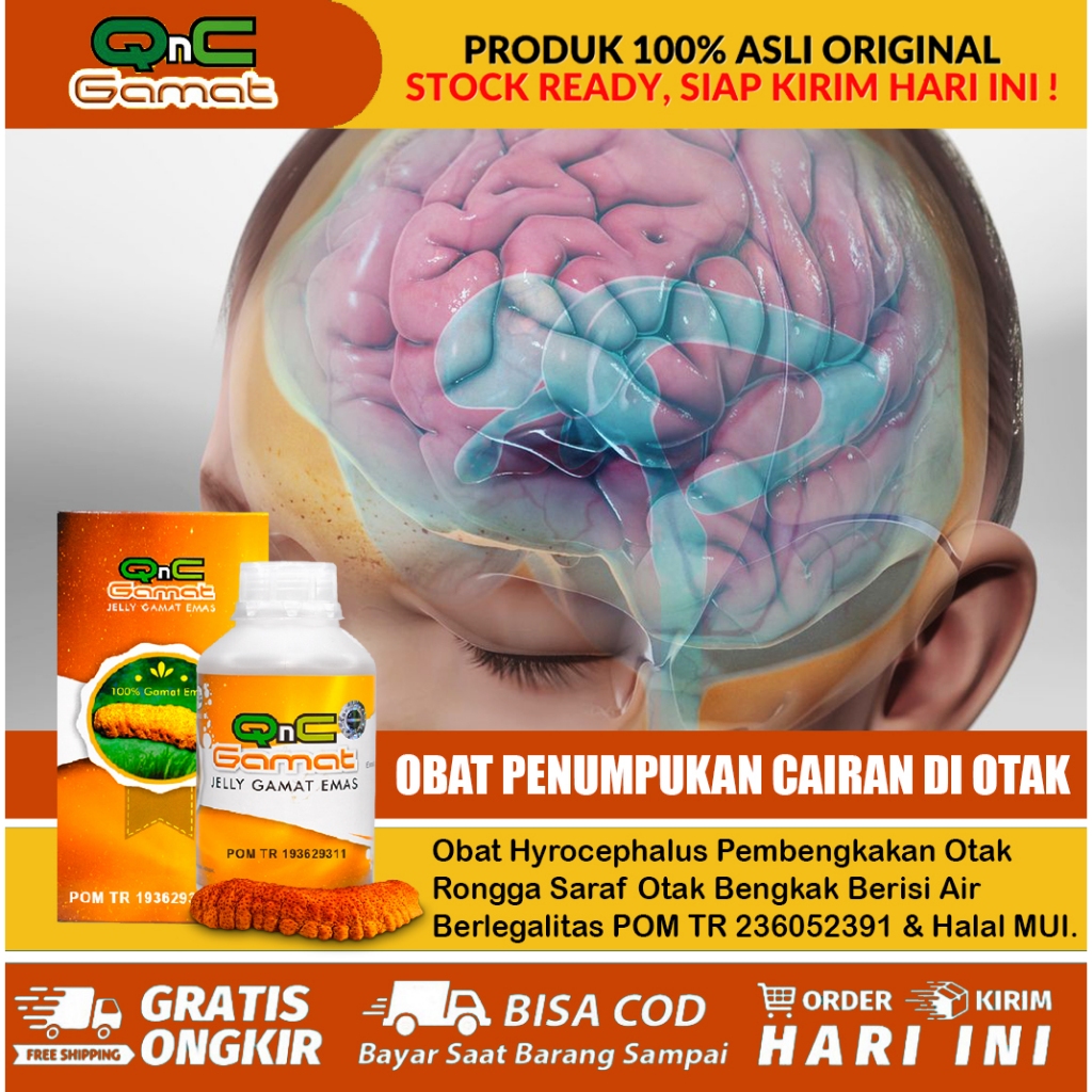 Obat Hydrocephalus Herbal, Penumpukan Cairan Di Rongga Otak, Pembengkakan Otak, Herbal Alami Hidrose