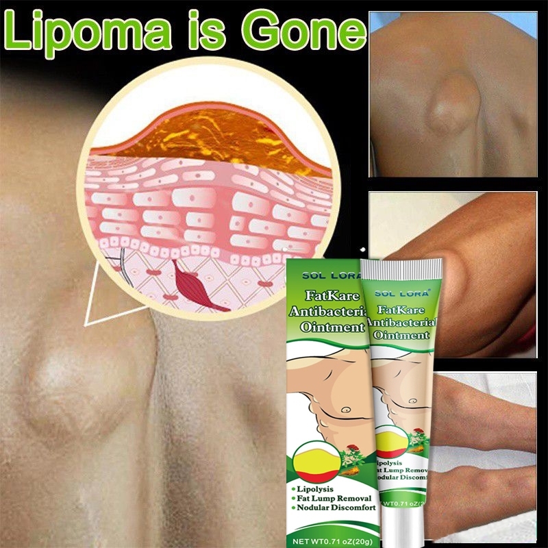 LIPOMA CREAM SUMIFUN