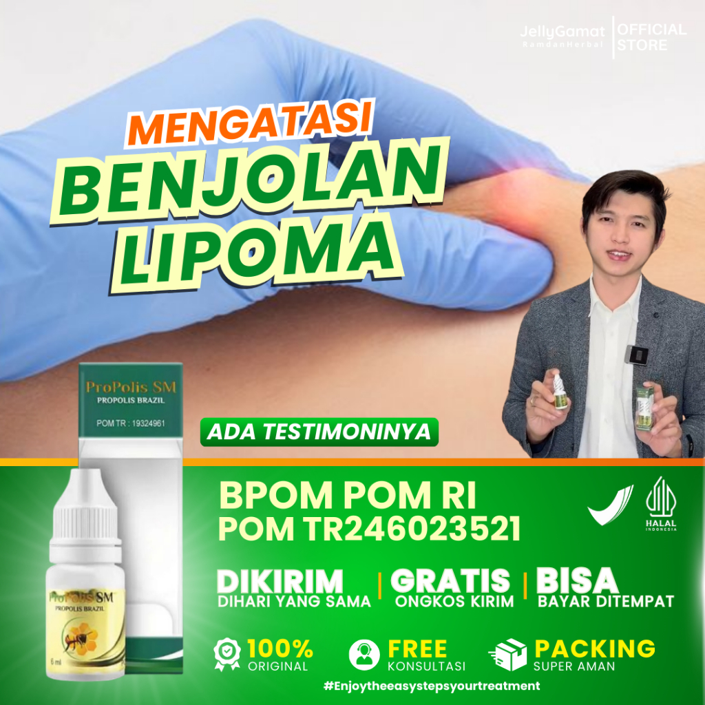 Obat Herbal Benjolan Lipoma | Obat Oles Benjolan Lipoma | Pengempis Benjolan Lipoma | Propolis SM
