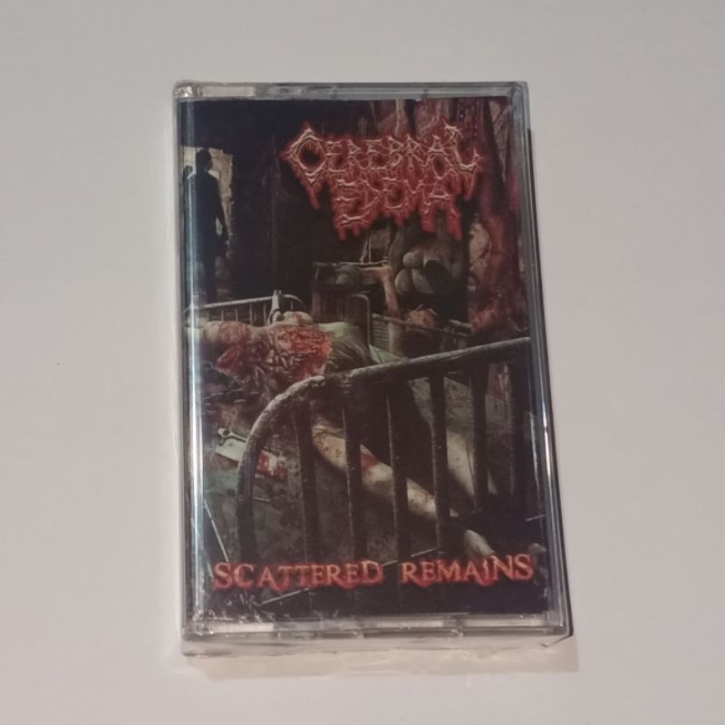 Kaset pita Cerebral edema - Scattered remains