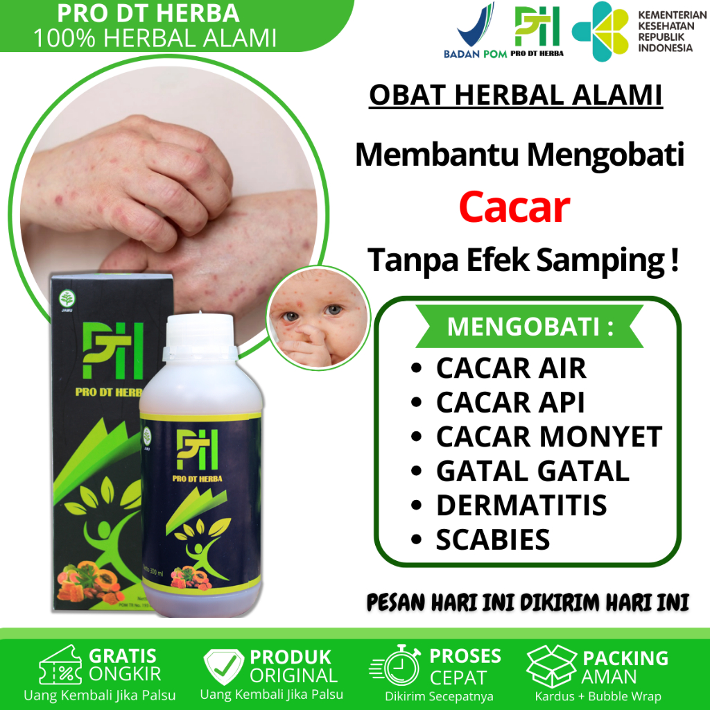 Obat Cacar Bintik Bintik Merah Berair Cacar Monyet Campak Penghilang Cacar Untuk Anak dan Dewasa
