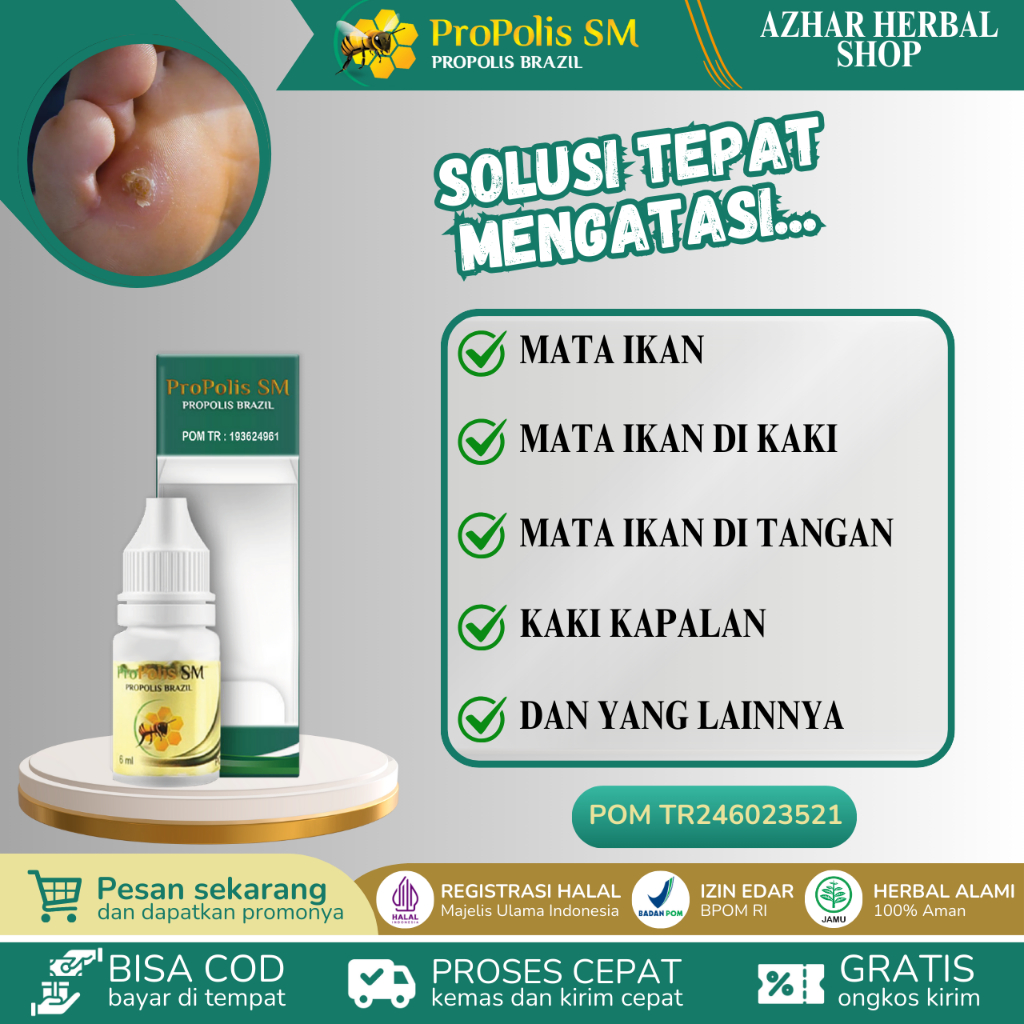 Propolis SM Obat Mata Ikan Pada Telapak Kaki Perontok Mata Ikan diTelapak Kaki & Tangan Kaki Kapalan