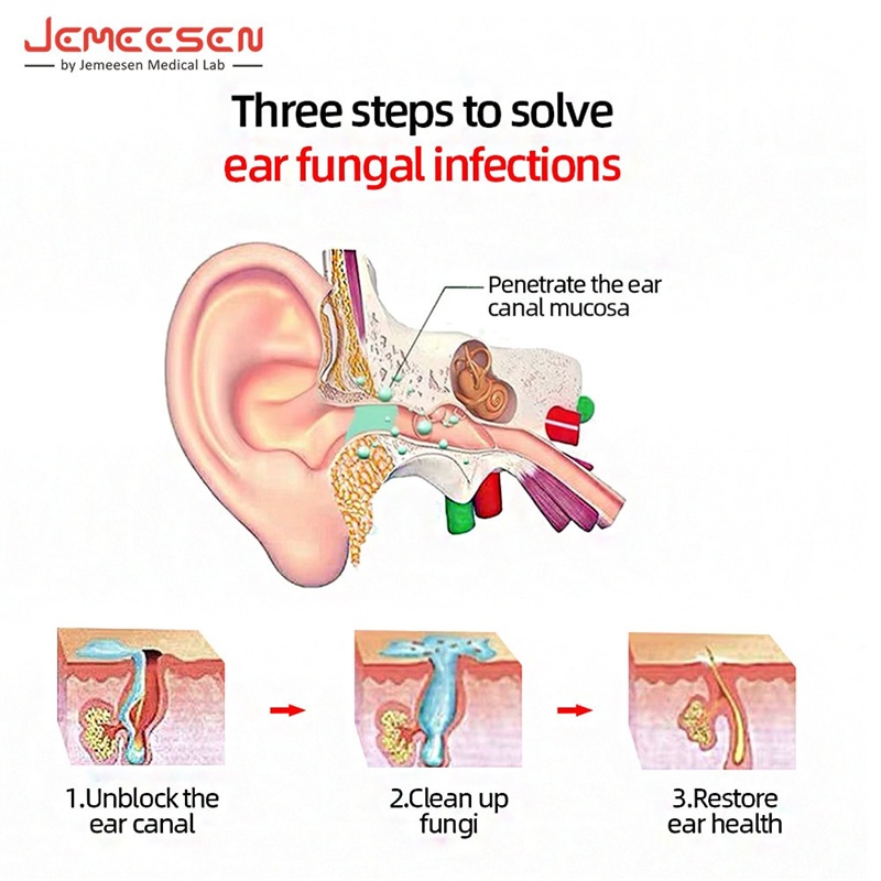 Jemeesen Tetes Telinga Tetes Telinga 20Ml Larutan Pembersih Telinga Tetes Telinga Penghilang Lilin