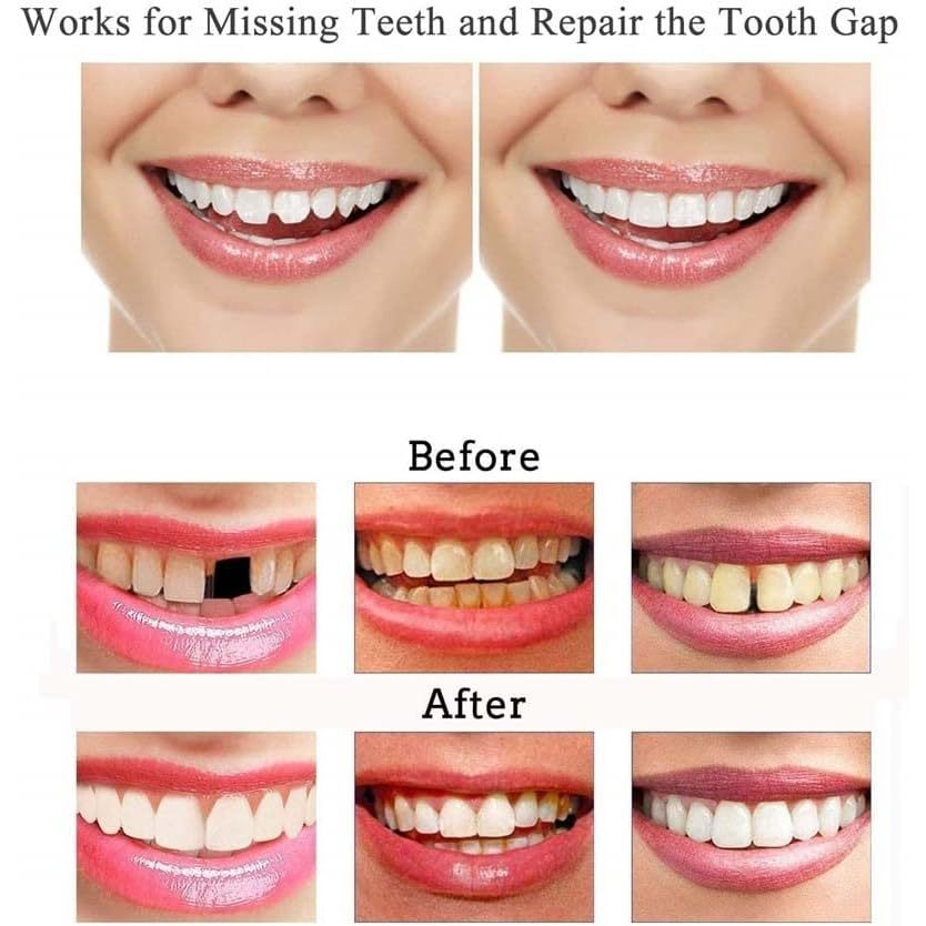 Penambal Gigi 1000 Butir - Temptooth Gigi Palsu Original / Gigi Palsu Temptooth / Temporary tooth | 