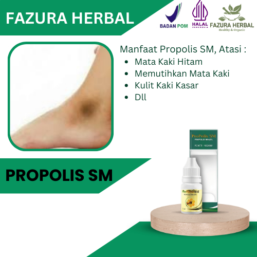 Propolis SM - Obat Mata Kaki Hitam, Obat Pemutih Mata Kaki, Obat Untuk Memutihkan Mata Kaki, Obat Ku