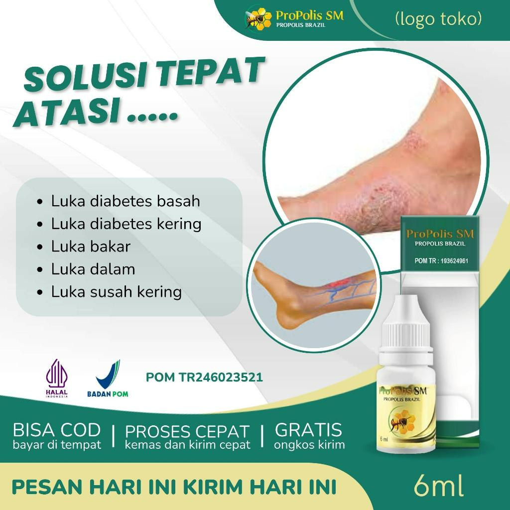 Obat Luka Diabetes, Obat Luka Jahitan, Obat Luka Bakar, Obat Luka Dalam, Obat Luka Susah Kering - Pr
