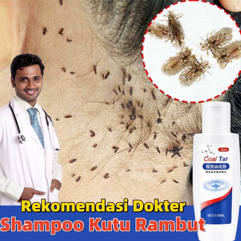 shampoo anti ketombe shampoo kutu rambut shampoo psoriasis penghilang ketombe anti gatal oil control