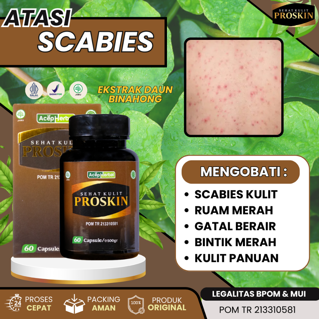 Obat Scabies, Obat Kudis Dan Kurap, Obat Gatal Berair, Obat Gatal Gatal, Obat Kutu Air, Gatal Panas 
