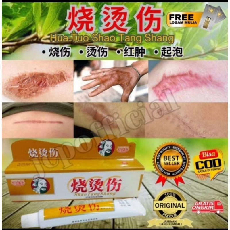 DiJAMIN ORIGINAL Salep KELOID dan Luka Bakar Melepuh
