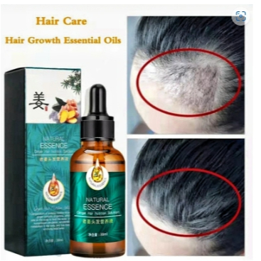Natural Essence Penumbuh Rambut 30ML/ Ginger Hair Serum Penumbuh Rambut Botak Ampuh Rambut Botak Ram
