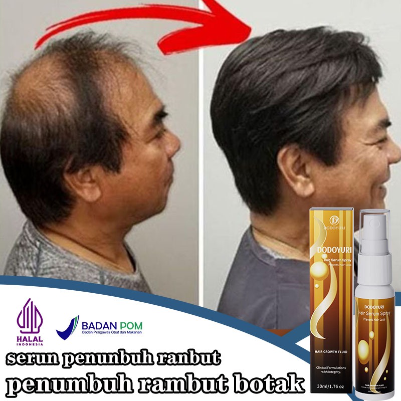 Obat penumbuh rambut  Serum penumbuh rambut penumbuh rambut cepat Pelebat rambut 30ml penumbuh rambu
