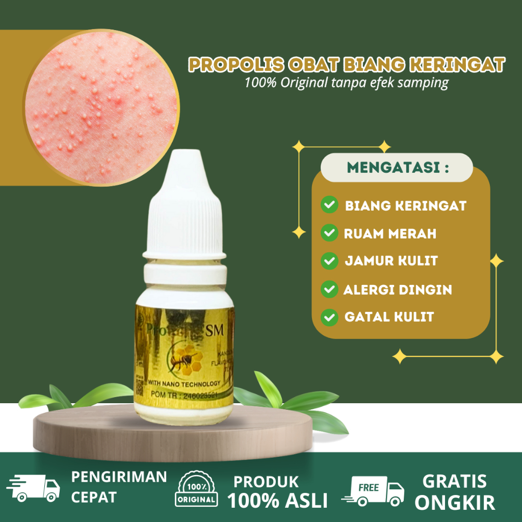 Obat biang keringat, obat gatal gatal dikulit, obat ruam merah dikulit, obat infeksi jamur kulit, ga