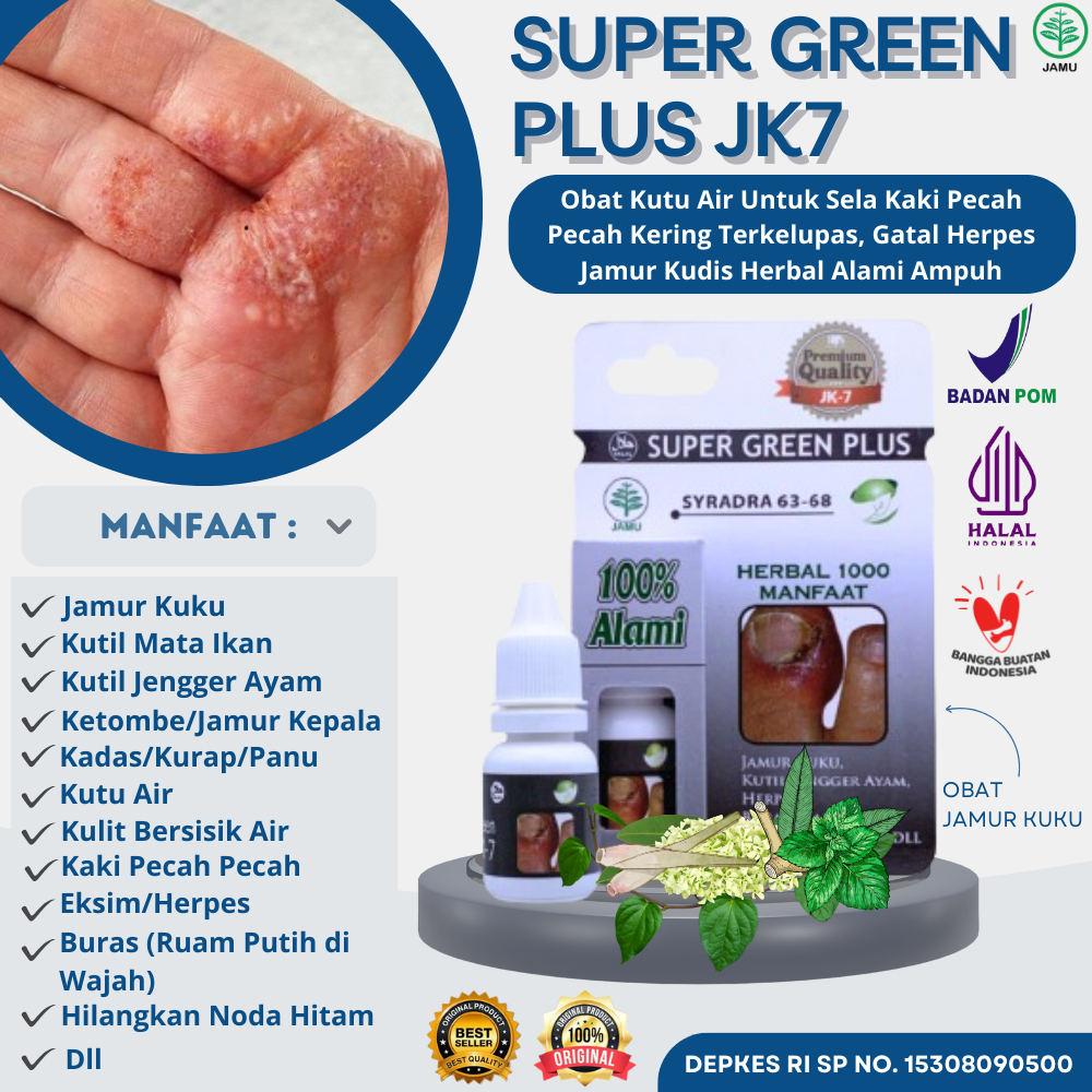Obat Kutu Air Untuk Sela Kaki Pecah Kering, Gatal Herpes Jamur Kudis Herbal Alami Ampuh SG JK7 BUKAN
