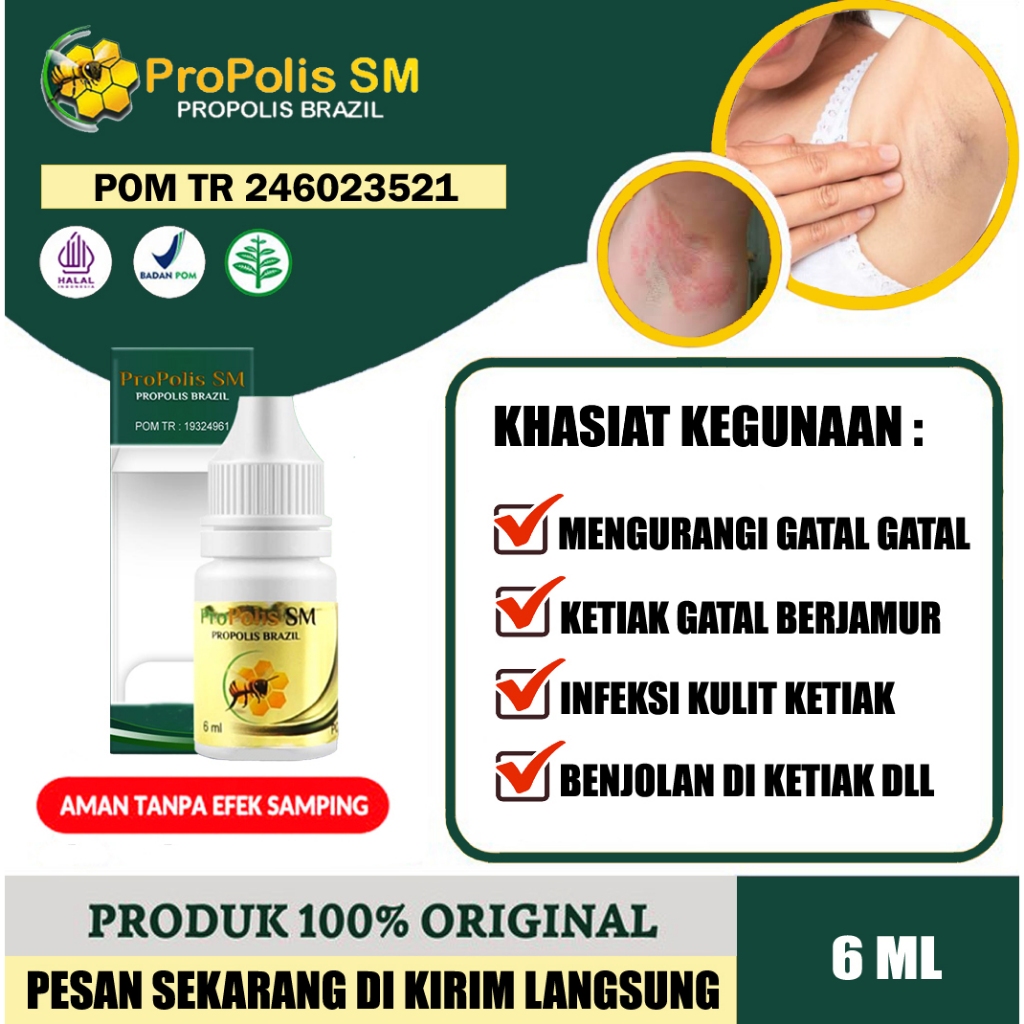 Obat Jamur Di Ketiak, Ketiak Lecet Dan Gatal, Ruam Ketiak, Salep Untuk Ketiak Lecet, Gatal Dan Perih