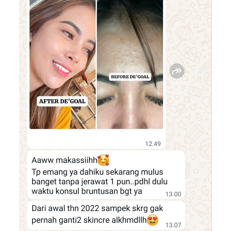 PAKET SKINCARE DE’GOAL WHITENING DAN ACNE GLOW