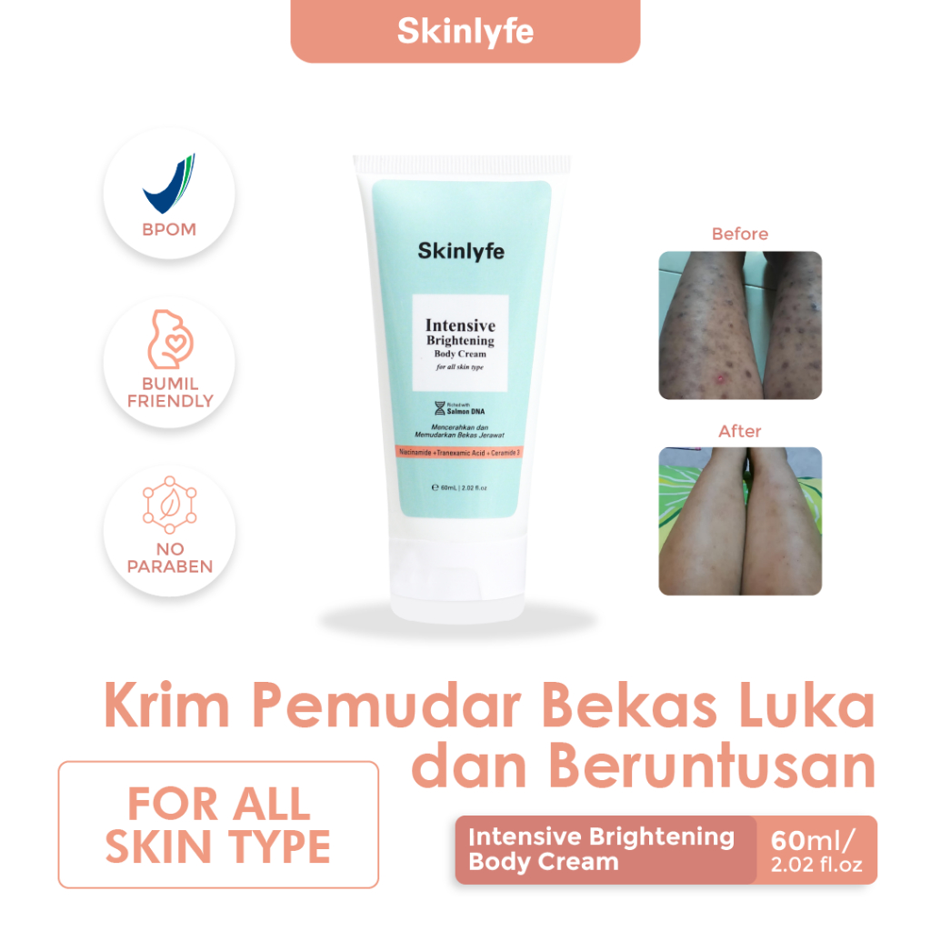 Skinlyfe Penghilang Bekas Luka Obat Bekas Koreng Penghilang Strechmark Ibu Hamil Salep Bekas Luka