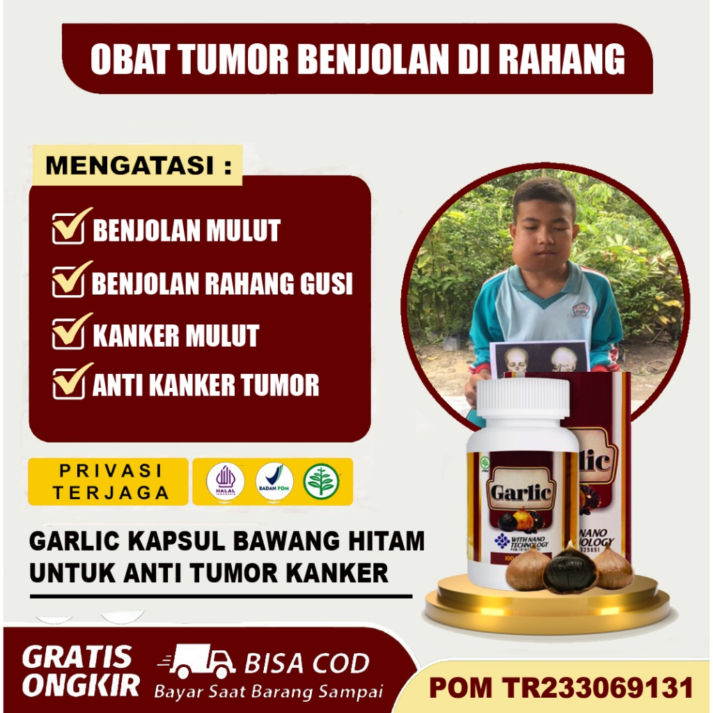 Obat Tumor Rahang Bengkak Penghilang Benjolan di Rahang Mulut Bennjolan Gusi Dalam Mulut Garlic Asli