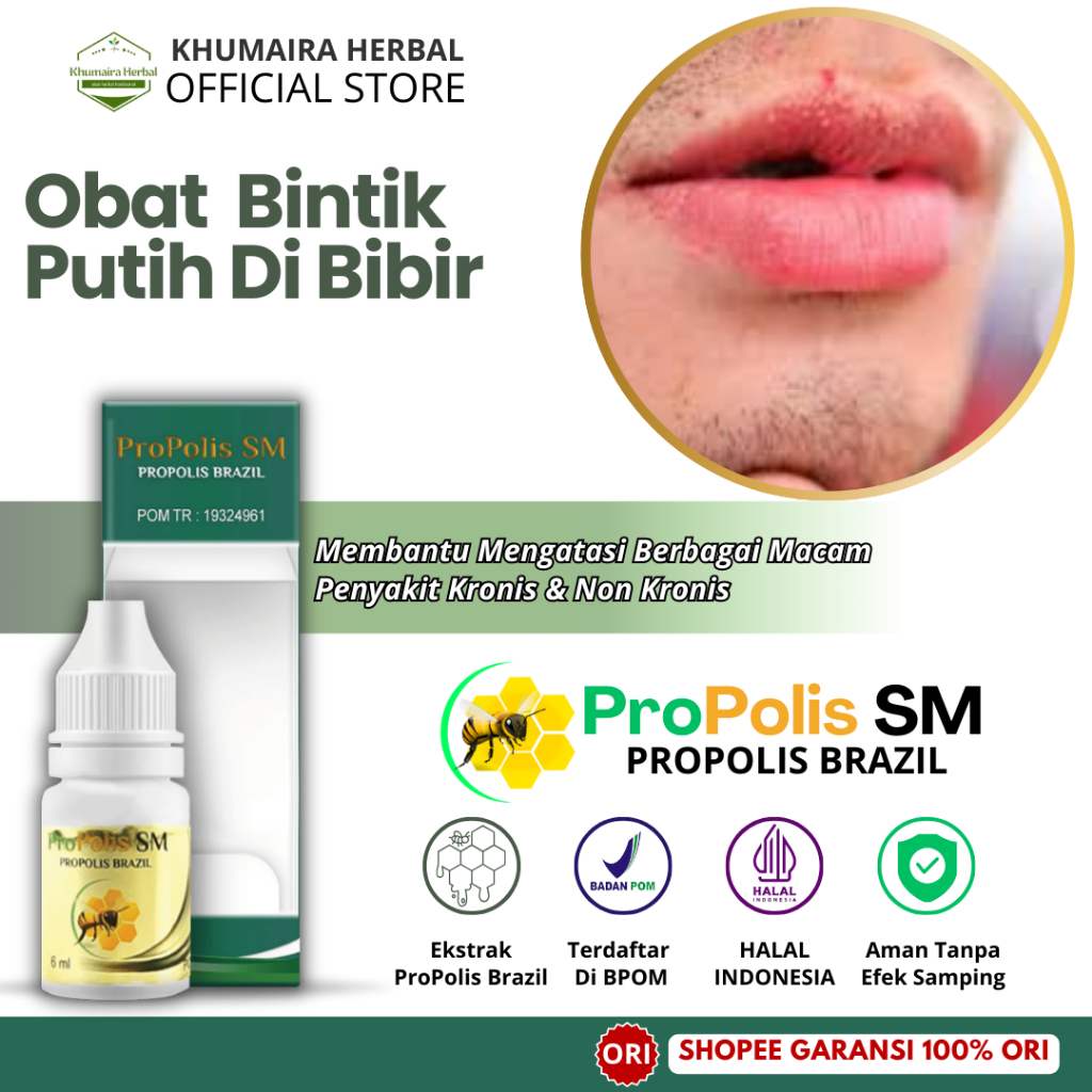 Obat Bintik Putih Di Bibir, Obat Penghilang Bintik Putih, Fordyce Spot, Obat Bibir Kering, Obat Gata