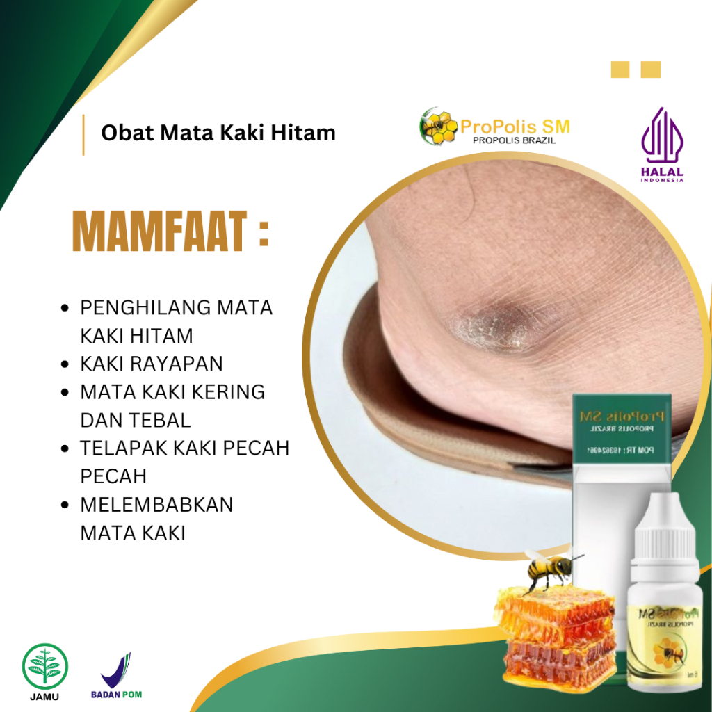 Obat Oles Mata Kaki Hitam, Obat Untuk Mata Kaki Hitam, Obat Pemutih Mata Kaki Hitam, Obat Kaki Kapal