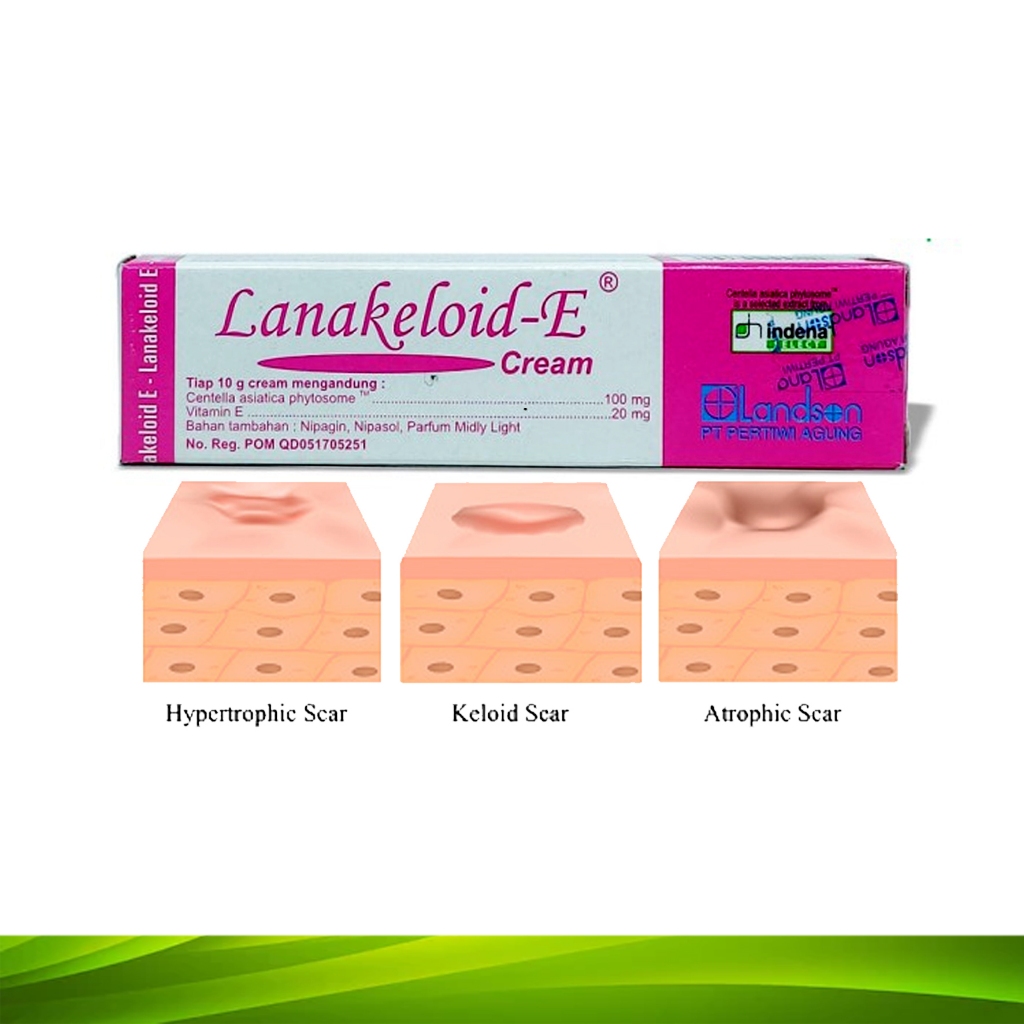 LANAKELOID E Krim Original Salep Keloid Pasca Operasi dan Bekas Luka Bakar
