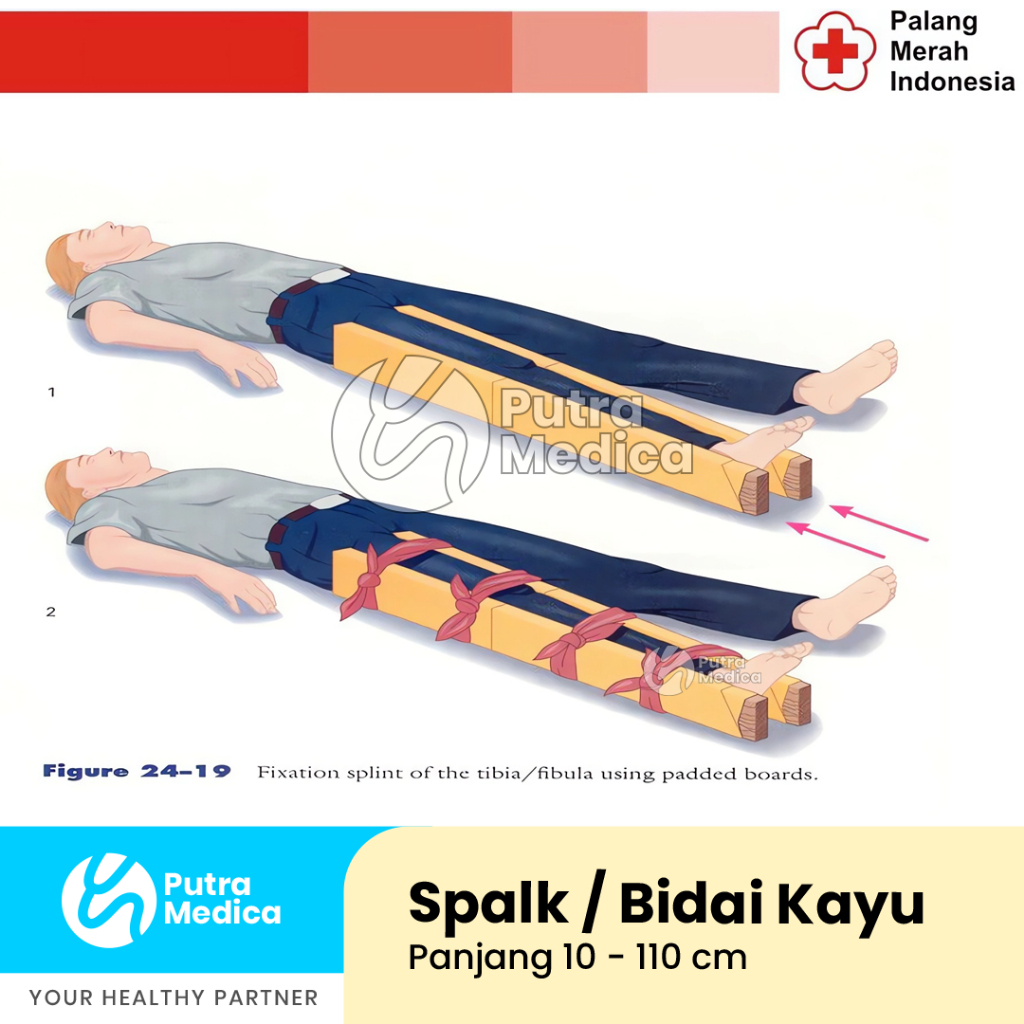 Spalk Bidai Kayu Spons 20cm x 5cm x 8mm - 1pc / Gips Patah Tulang / Penyangga Cedera Kaki Tangan