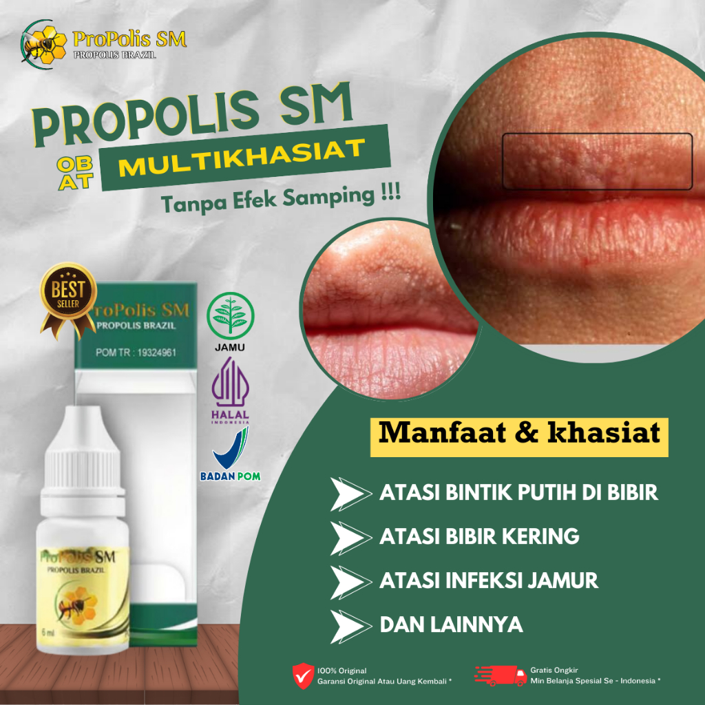 Obat Penghilang Bintik Putih di Bibir, Obat Herpes Bibir,Obat Bibir Kering, Obat Bibir Pecah Pecah, 