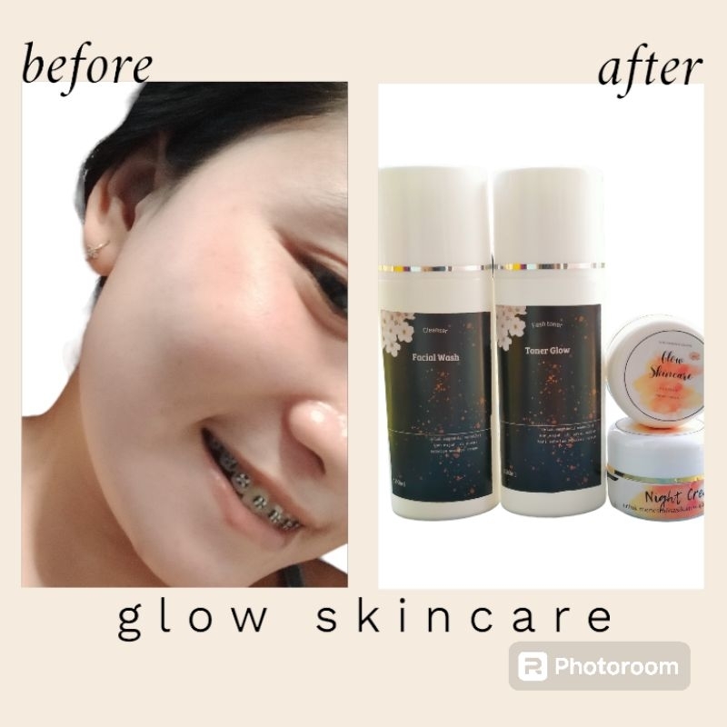 Glow Skincare Beauty //Cream pemutih wajah ampuh//Cream Glowing//Cream viral