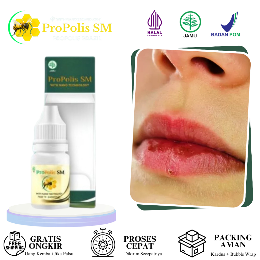 Obat Bibir Pecah-Pecah, Bibir Kering Pecah Berdarah, Bibir Mengelupas, Luka Di Bibir, Sariawan, Pera