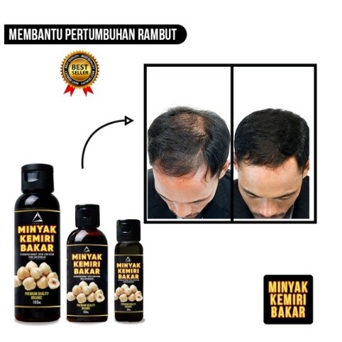 [ BPOM] MINYAK KEMIRI BAKAR & MINYAK KEMIRI MURNI 100% ORIGILAL 100ML| MINYAK KEMIRI PENUMBUH RAMBUT