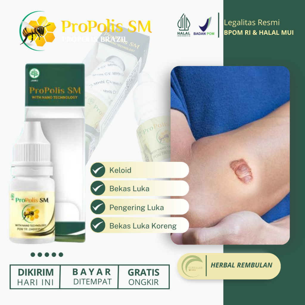 Obat Penghilang Keloid, Obat Keloid Menahun, Obat Keloid Injeksi, Obat Keloid Bekas Operasi, Obat Pe