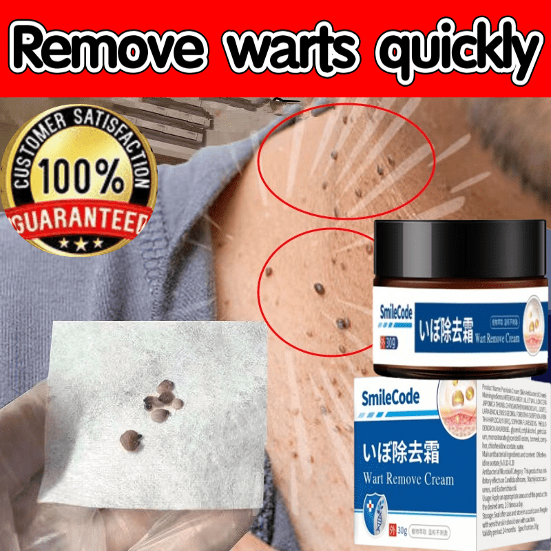 obat kutil paling ampuh oles 20g obat kutil Krim Penghilang Kutil paling Mudah Dibawa Untuk Semua Ku