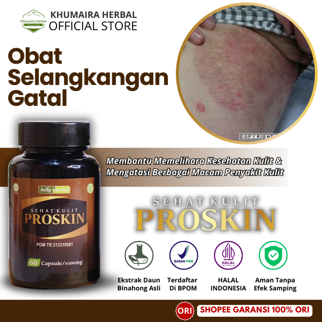 Obat Ruam di Selangkangan, Gatel Menahun di Selangkangan, Selangkangan Hitam dan Gatal, Selangkangan