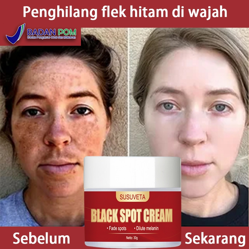 Penghilang flek hitam membandel flek hitam di wajah membandel cream flek hitam membandel 30g penghil