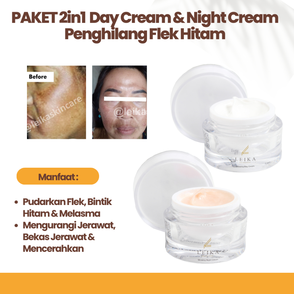 [PAKET 2in1 DAY CREAM & NIGHT CREAM] Penghilang Flek Hitam Membandel Untuk Menghilangkan Flek Hitam 